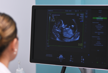servicio-maternoFetal